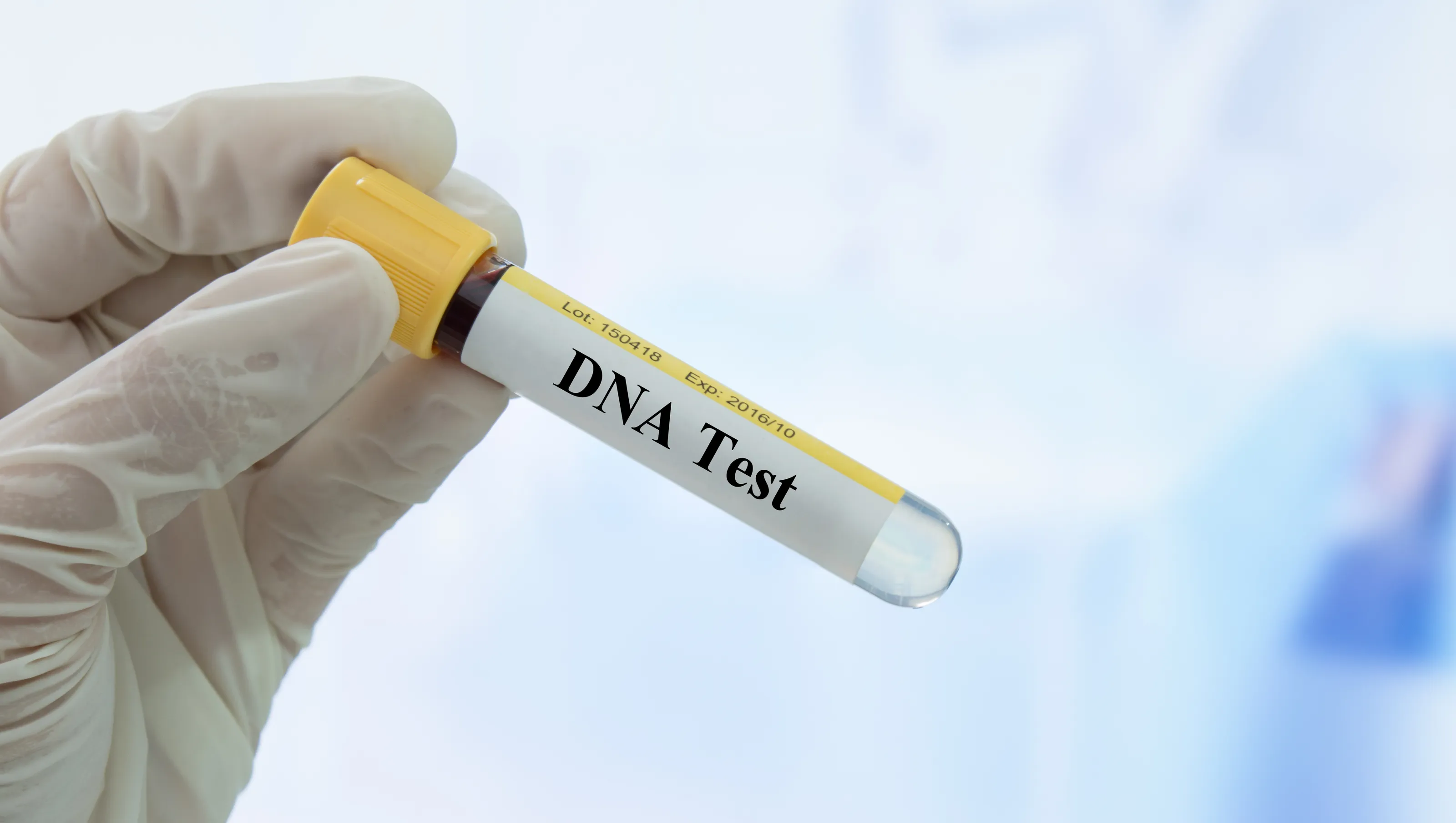 Genetic Testing